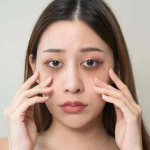 Eye Serums for Dark Circles
