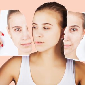 facial skin ageing